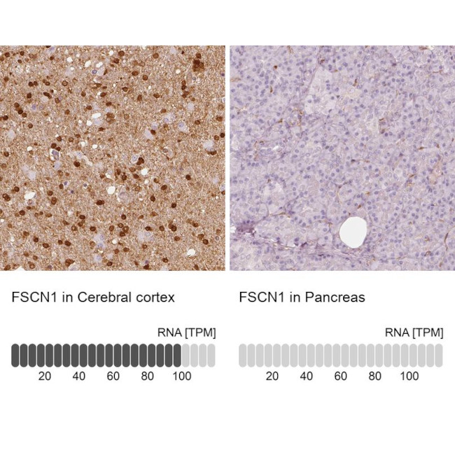 Fascin Antibody