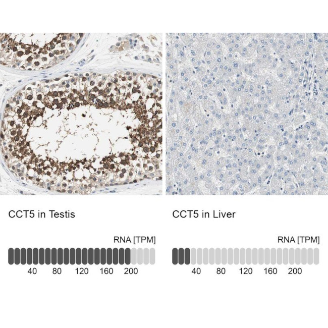 TCP-1 epsilon Antibody