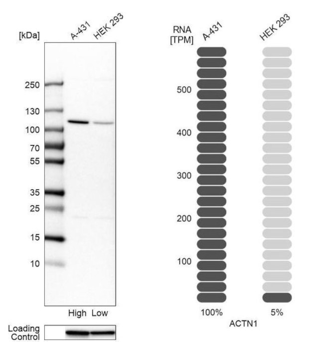 alpha Actinin 1 Antibody