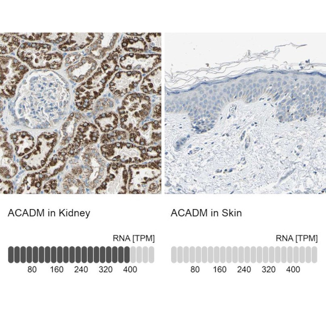 ACADM Antibody