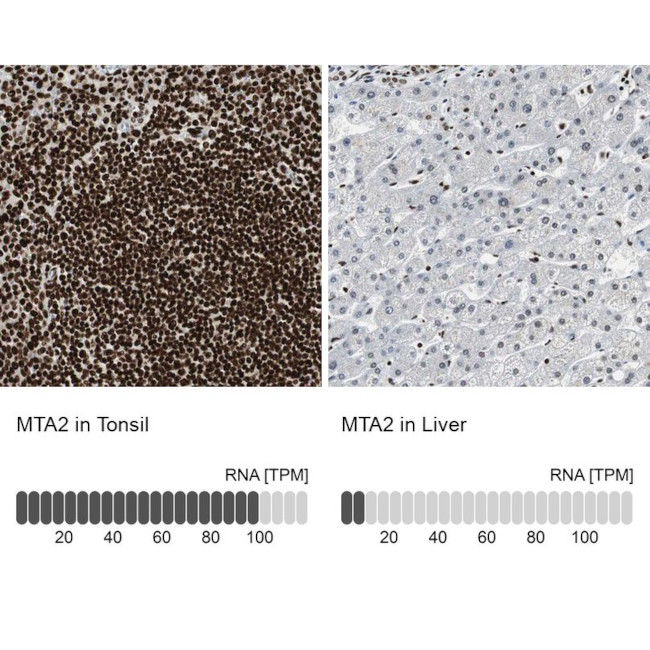 MTA2 Antibody