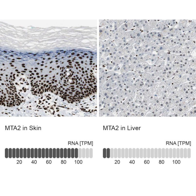 MTA2 Antibody