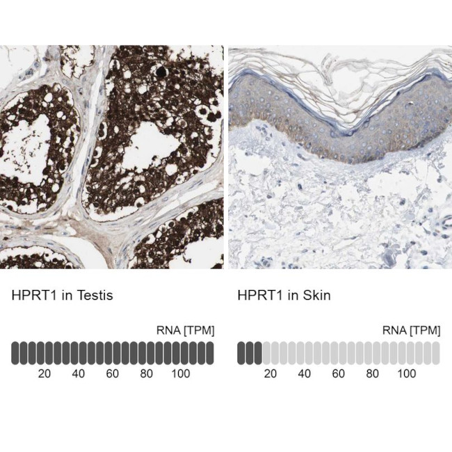 HPRT1 Antibody