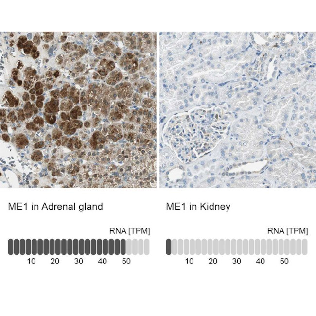 ME1 Antibody