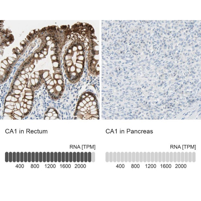 Carbonic Anhydrase I Antibody