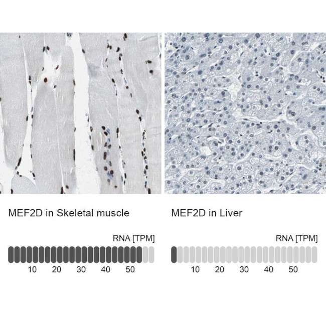 MEF2D Antibody