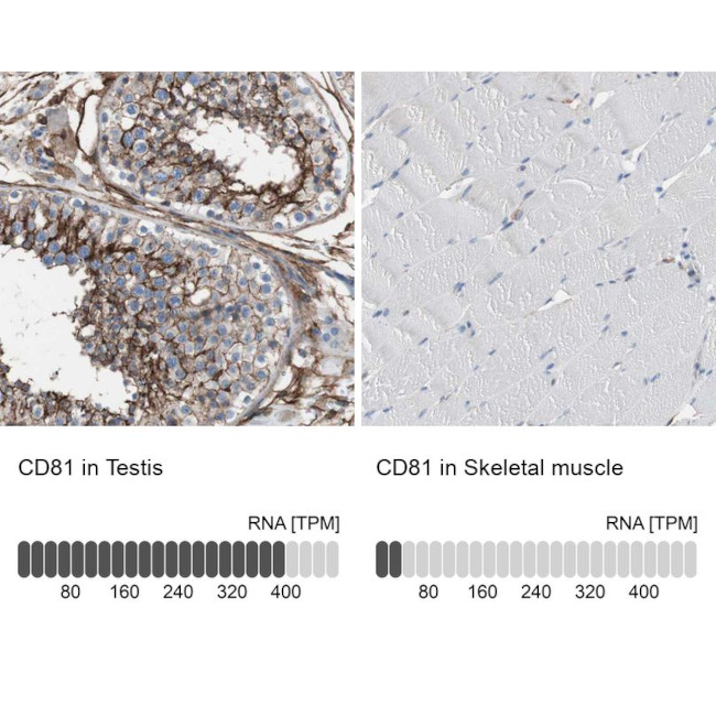 CD81 Antibody