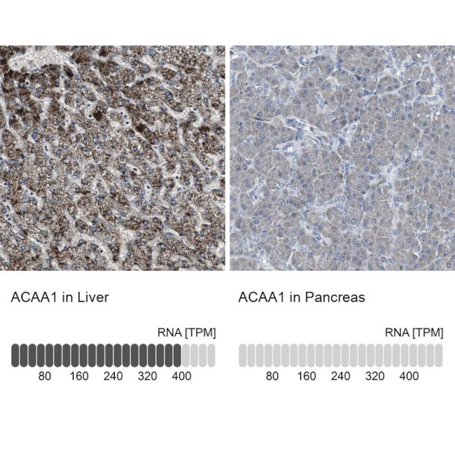 ACAA1 Antibody