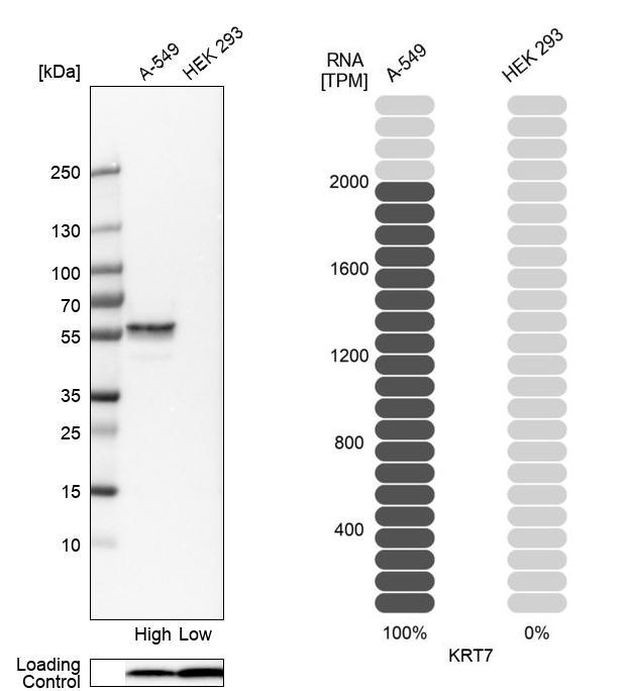 Cytokeratin 7 Antibody