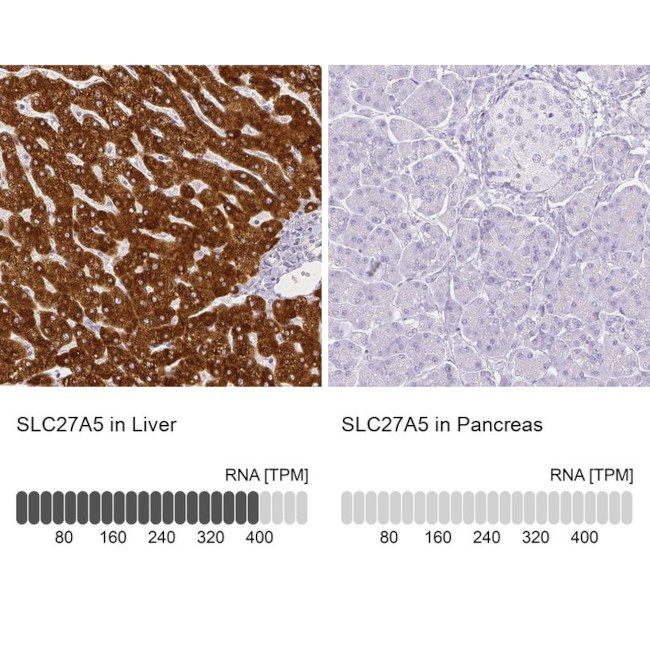 SLC27A5 Antibody