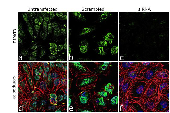 CDK12 Antibody