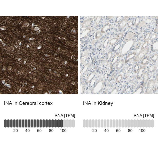 alpha Internexin Antibody