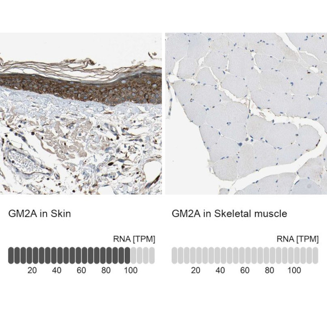 GM2A Antibody