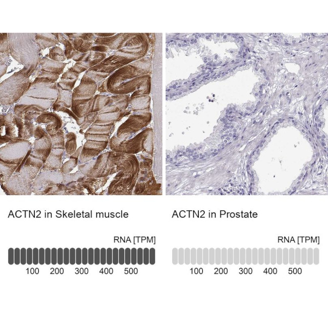 alpha Actinin 2 Antibody