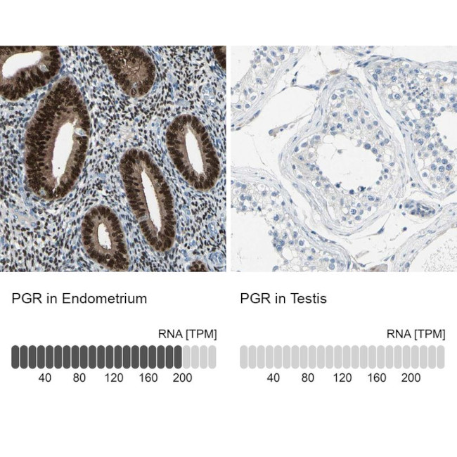 Progesterone Receptor Antibody