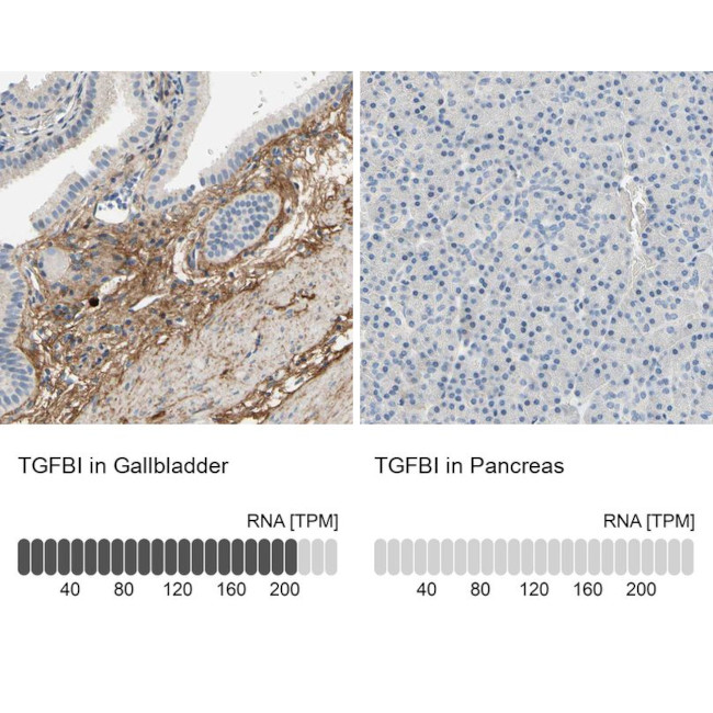 TGFBI Antibody