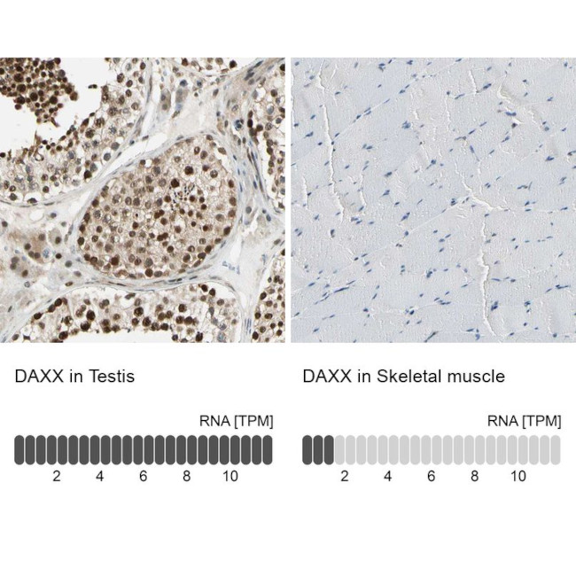 DAXX Antibody