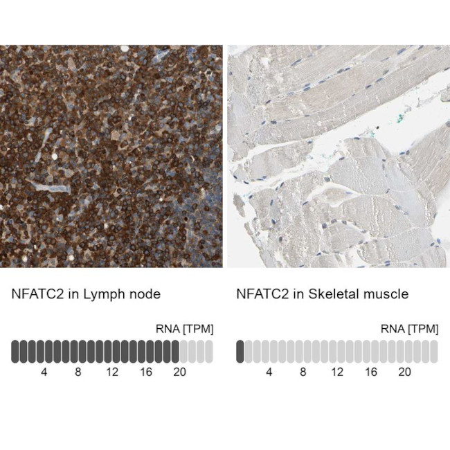 NFATC2 Antibody