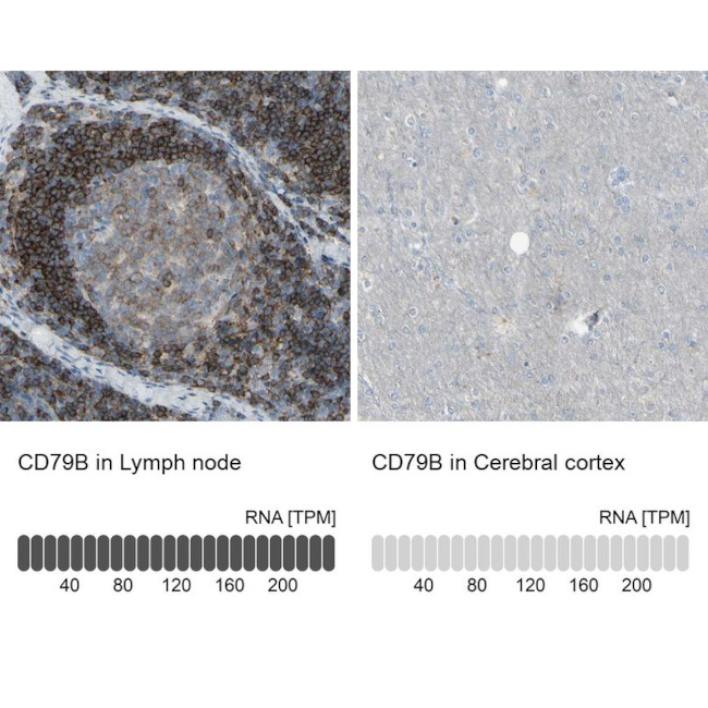 CD79b Antibody