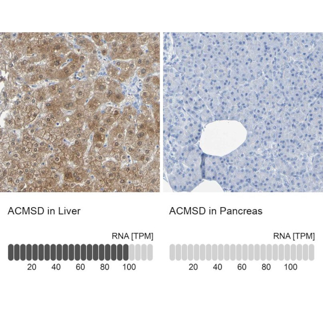 ACMSD Antibody