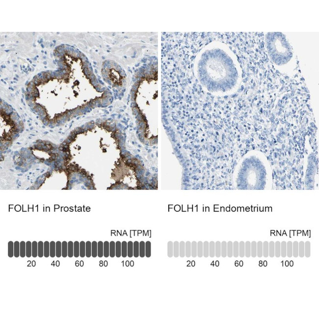 PSMA Antibody