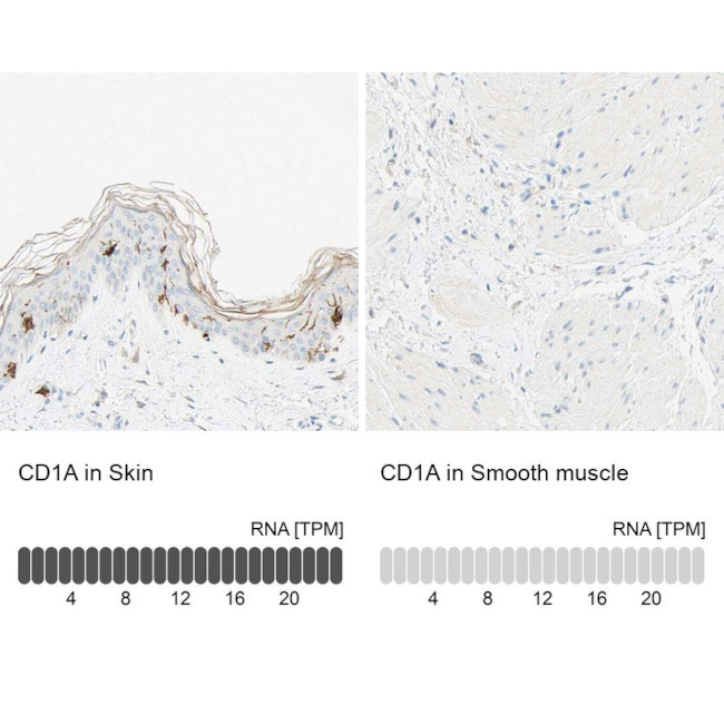 CD1a Antibody