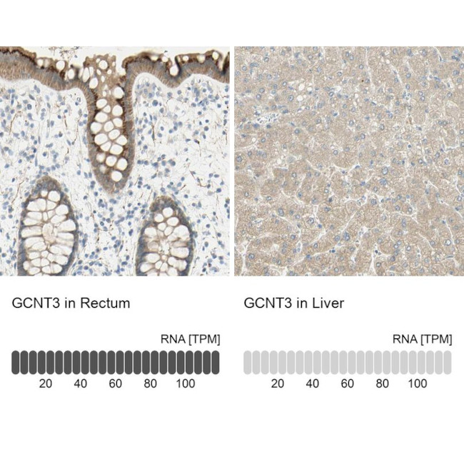 GCNT3 Antibody