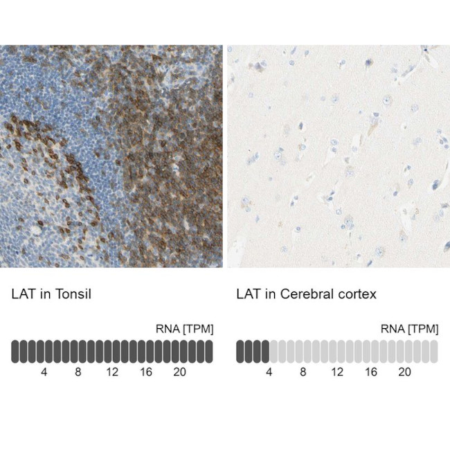 LAT Antibody