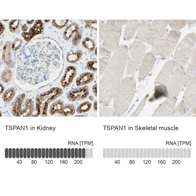 TSPAN1 Antibody