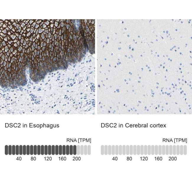 Desmocollin 2 Antibody