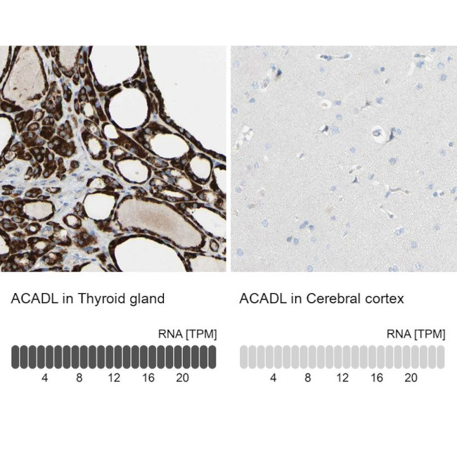 ACADL Antibody