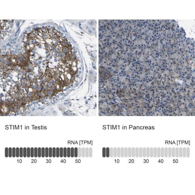 STIM1 Antibody