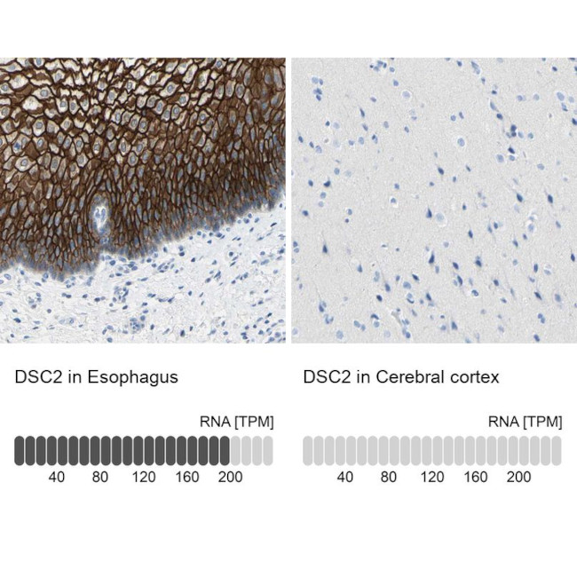 Desmocollin 2 Antibody