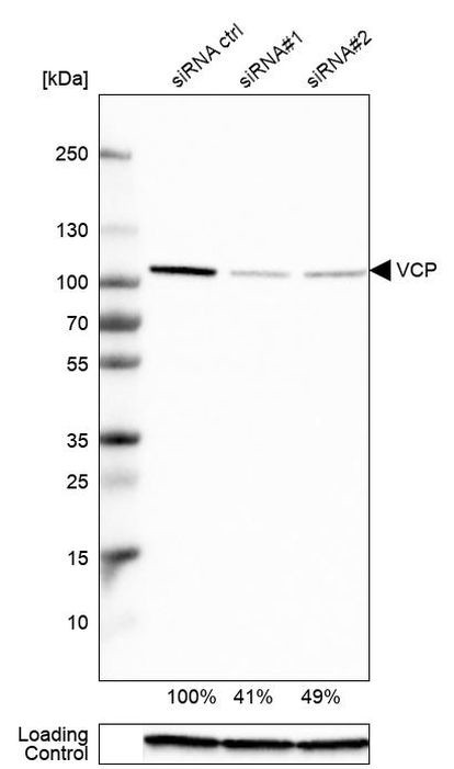 VCP Antibody