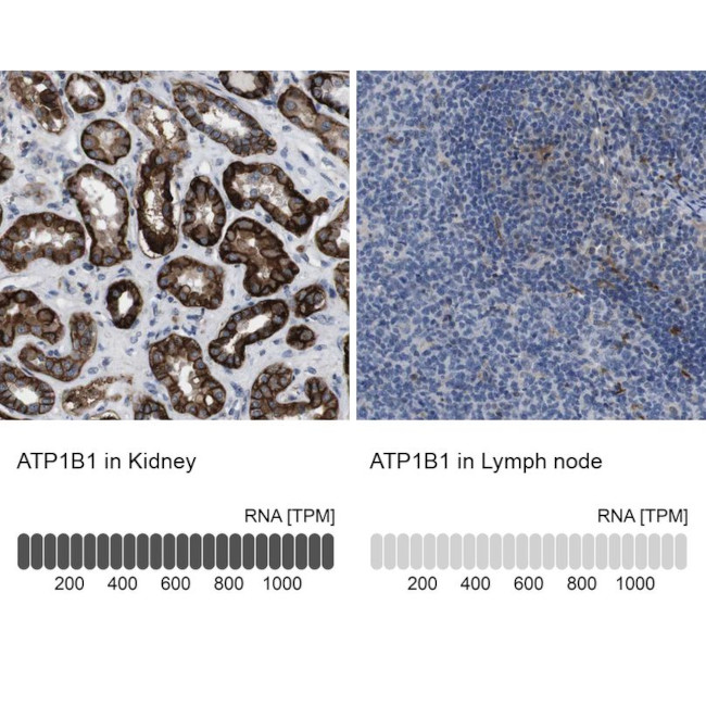 ATP1B1 Antibody