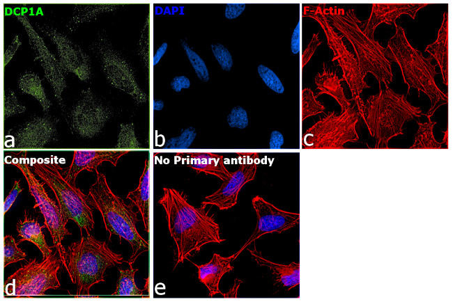 DCP1A Antibody in Immunocytochemistry (ICC/IF)