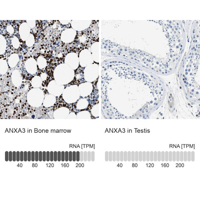 Annexin A3 Antibody