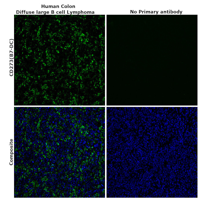 CD273 (B7-DC) Antibody in Immunohistochemistry (Paraffin) (IHC (P))