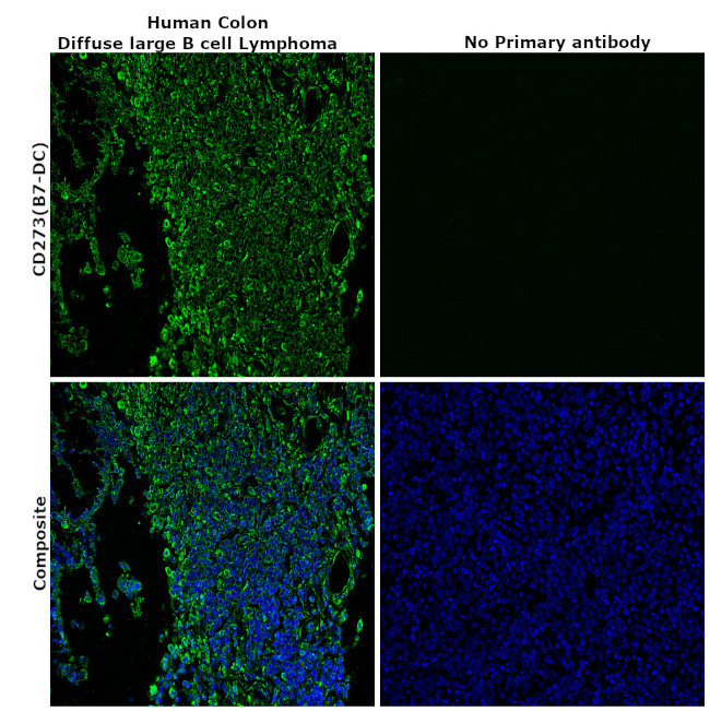 CD273 (B7-DC) Antibody in Immunohistochemistry (Paraffin) (IHC (P))