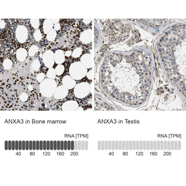 Annexin A3 Antibody