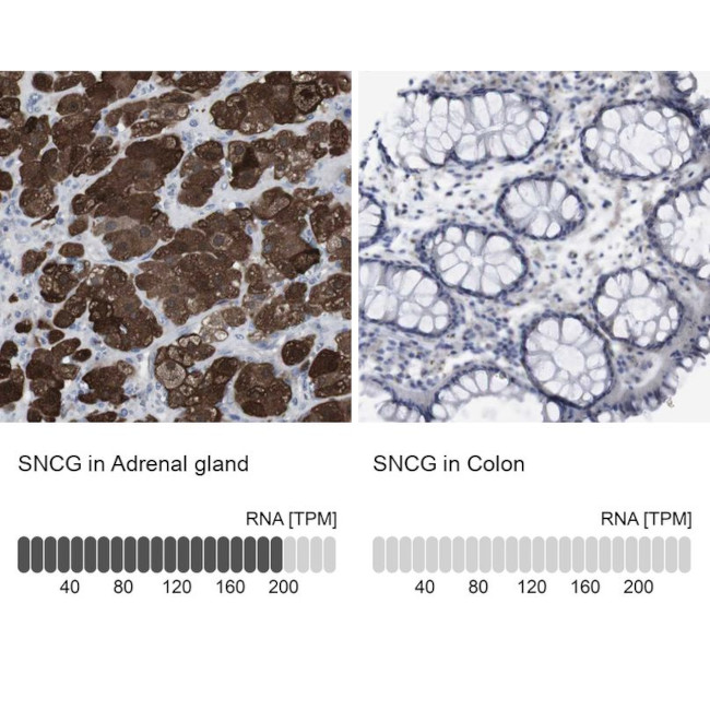 gamma Synuclein Antibody