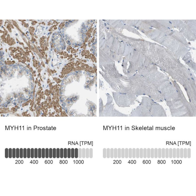 MYH11 Antibody