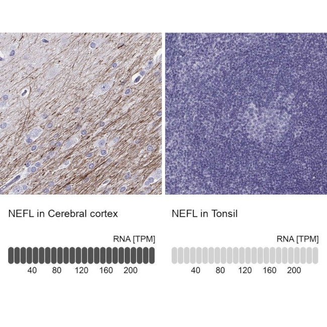 NEFL Antibody