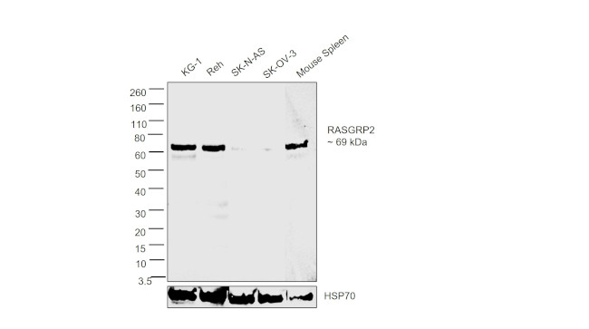 RASGRP2 Antibody in Western Blot (WB)