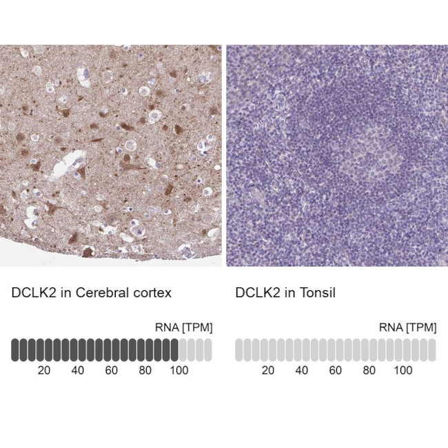 DCAMKL2 Antibody