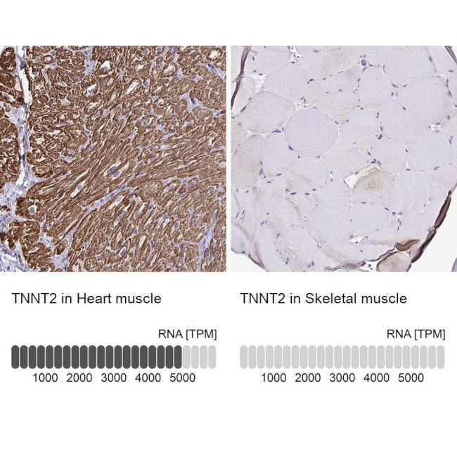 Cardiac Troponin T Antibody