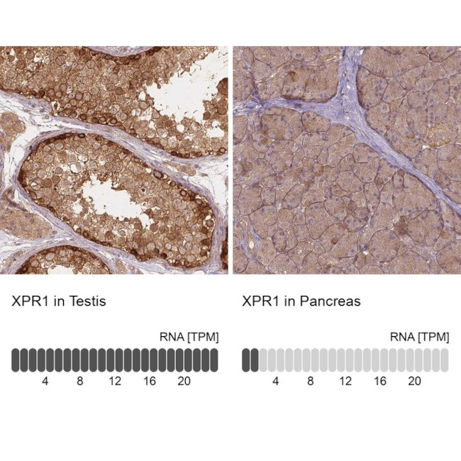 XPR1 Antibody