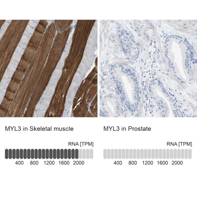 MYL3 Antibody