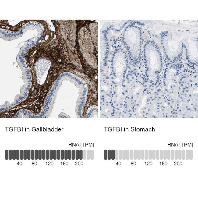 TGFBI Antibody