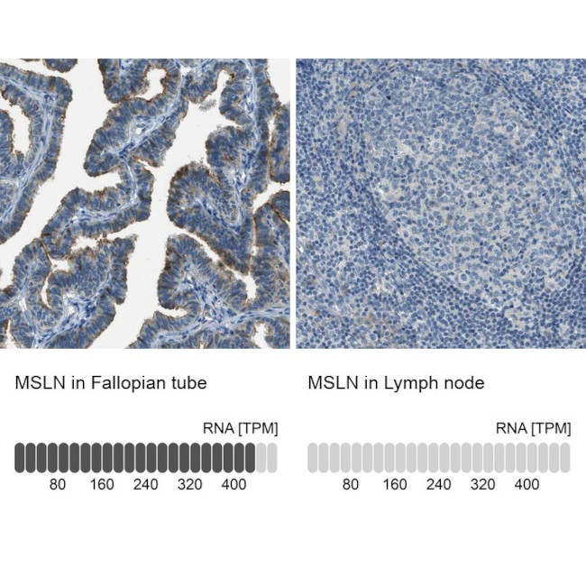 Mesothelin Antibody